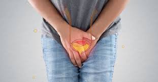 [INCONTINENCIA bexiga hiperativa o que é e como tratar?]  Interstim marca passo na bexiga | perda de urina constante. NÃO PARO DE IR AO BANHEIRO. ESSE PROBLEMA TEM SOLUÇÃO?